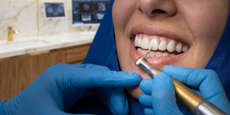 Cosmetic dentistry — smile transformation and veneers